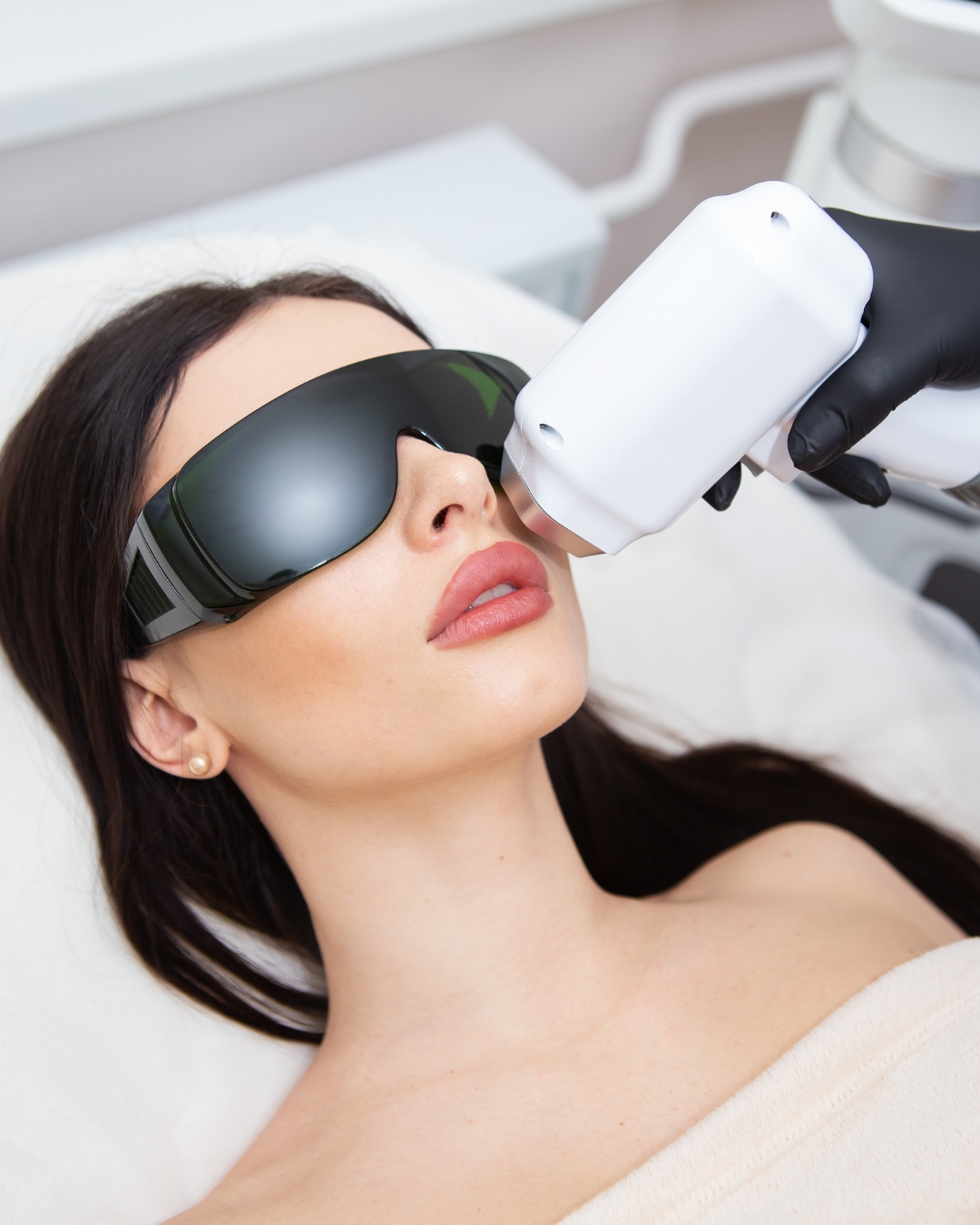LASER HAIR REMOVAL